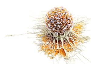 Нейрон-специфическая энолаза (NSE) — зачем нужен анализ, интерпретация результатов