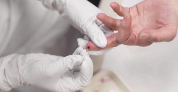 Анализ на фруктозамин: показания и расшифровка