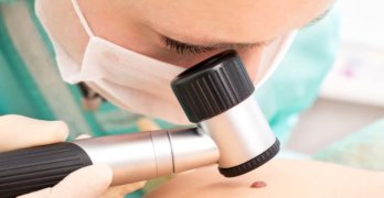 Стадии меланомы кожи — что означают цифры от 0 до 4, TNM классификация, прогноз